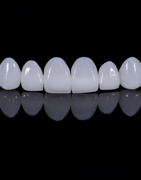 Several white dental veneers against black background