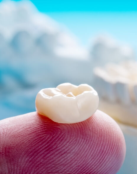 Close up of dental crown resting on finger
